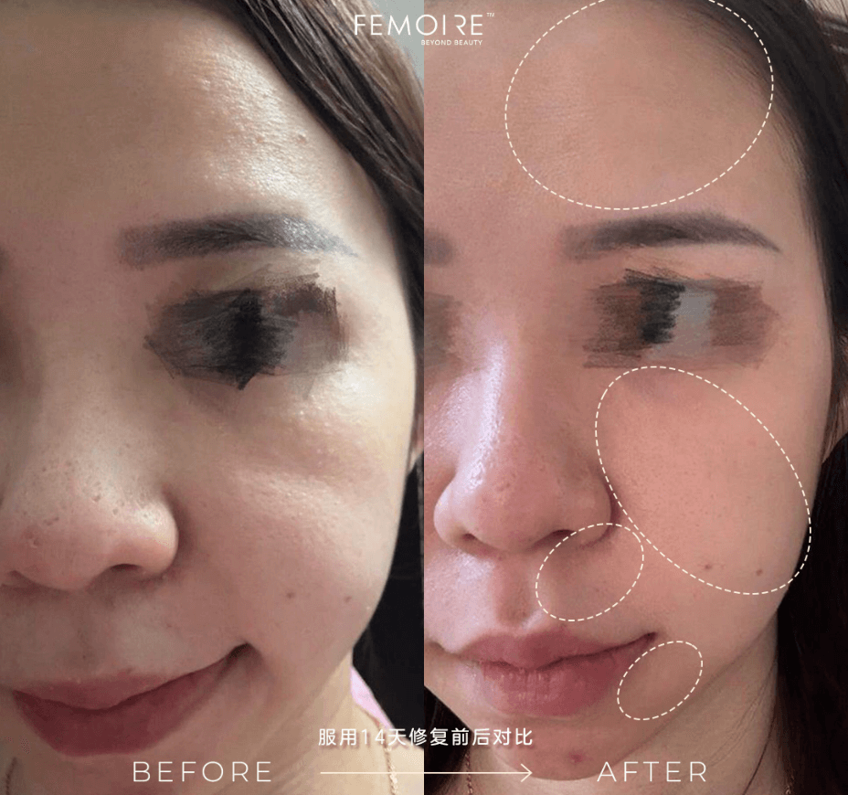 Femoire Testimonial_Before & After_1