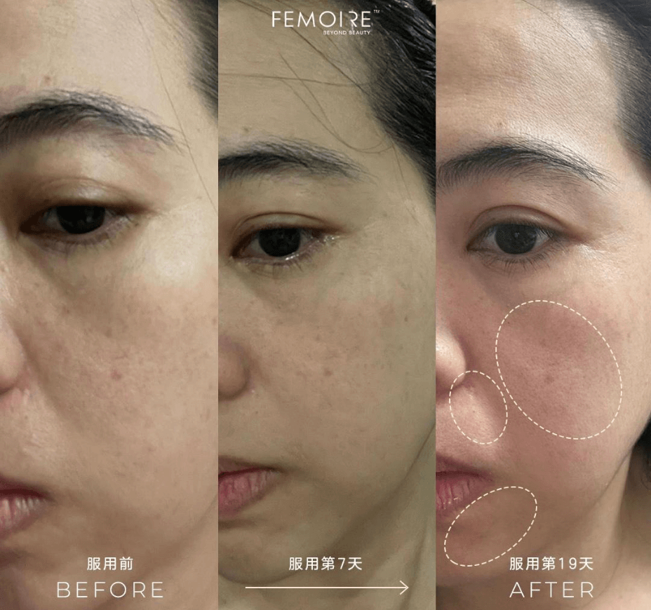 Femoire Testimonial_Before & After_2