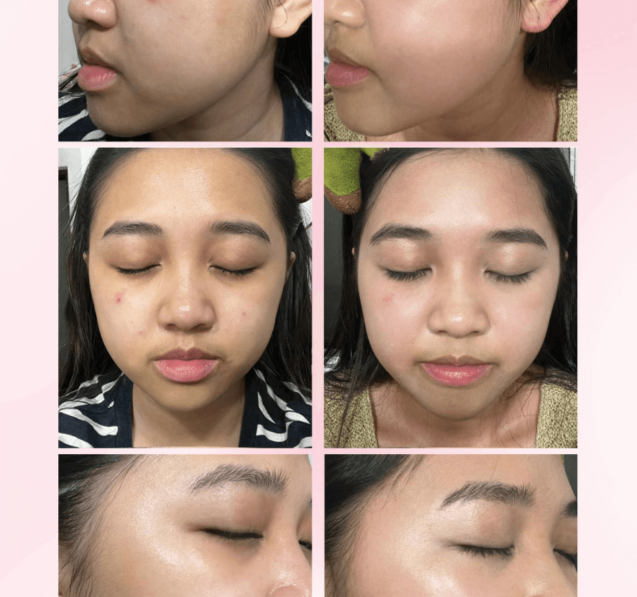 Femoire Testimonial_Before & After_4
